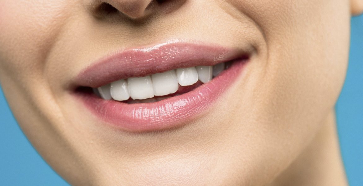 El blanqueamiento dental es mejor después de la ortodoncia