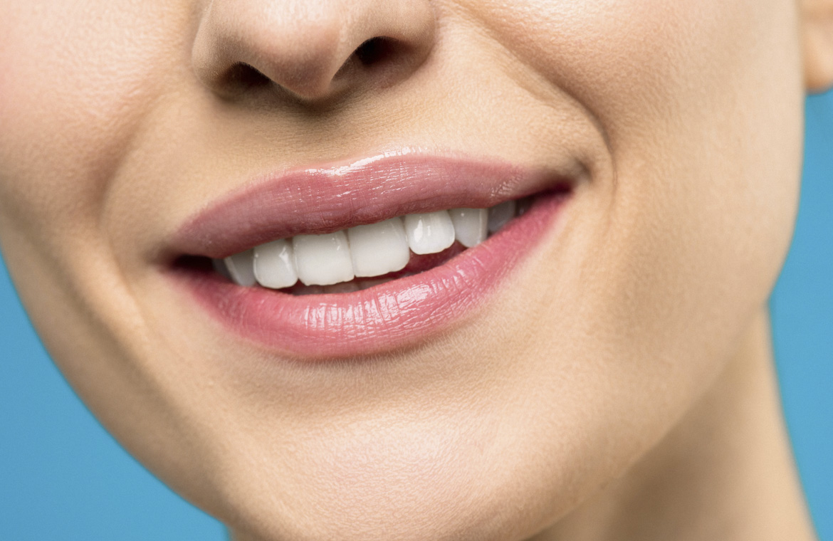 El blanqueamiento dental es mejor después de la ortodoncia