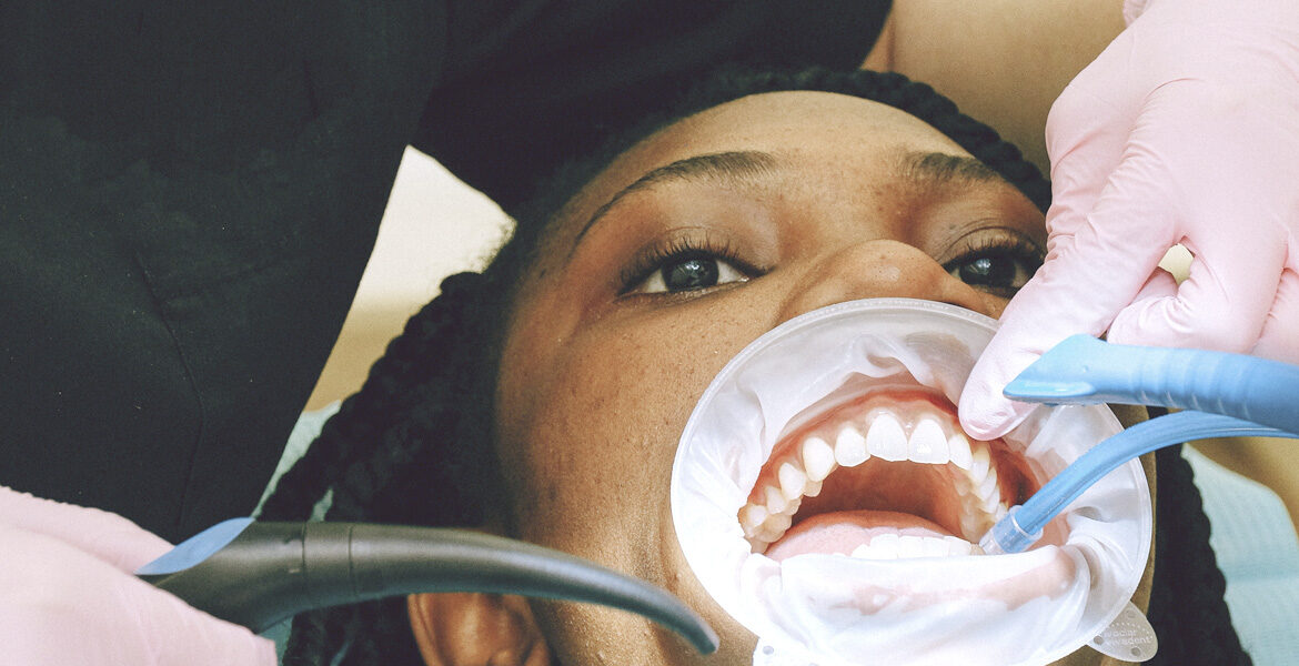 Abscesos dentales, una lesión que debe tratarse