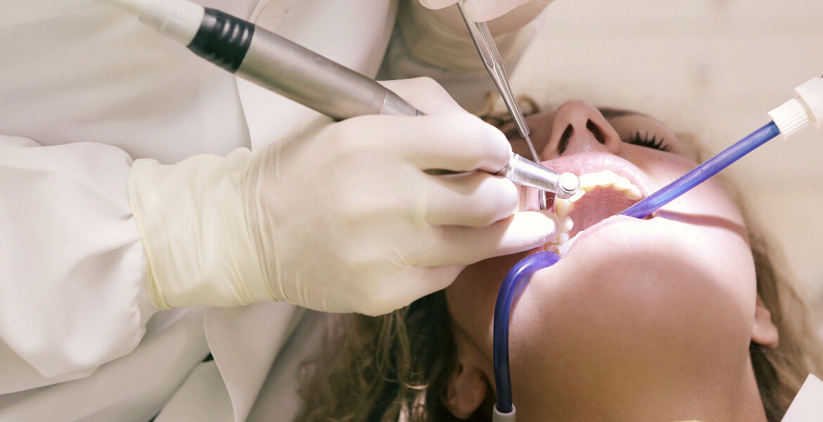 Protege tu salud bucodental con las limpiezas profesionales de Clínica Dental Simón