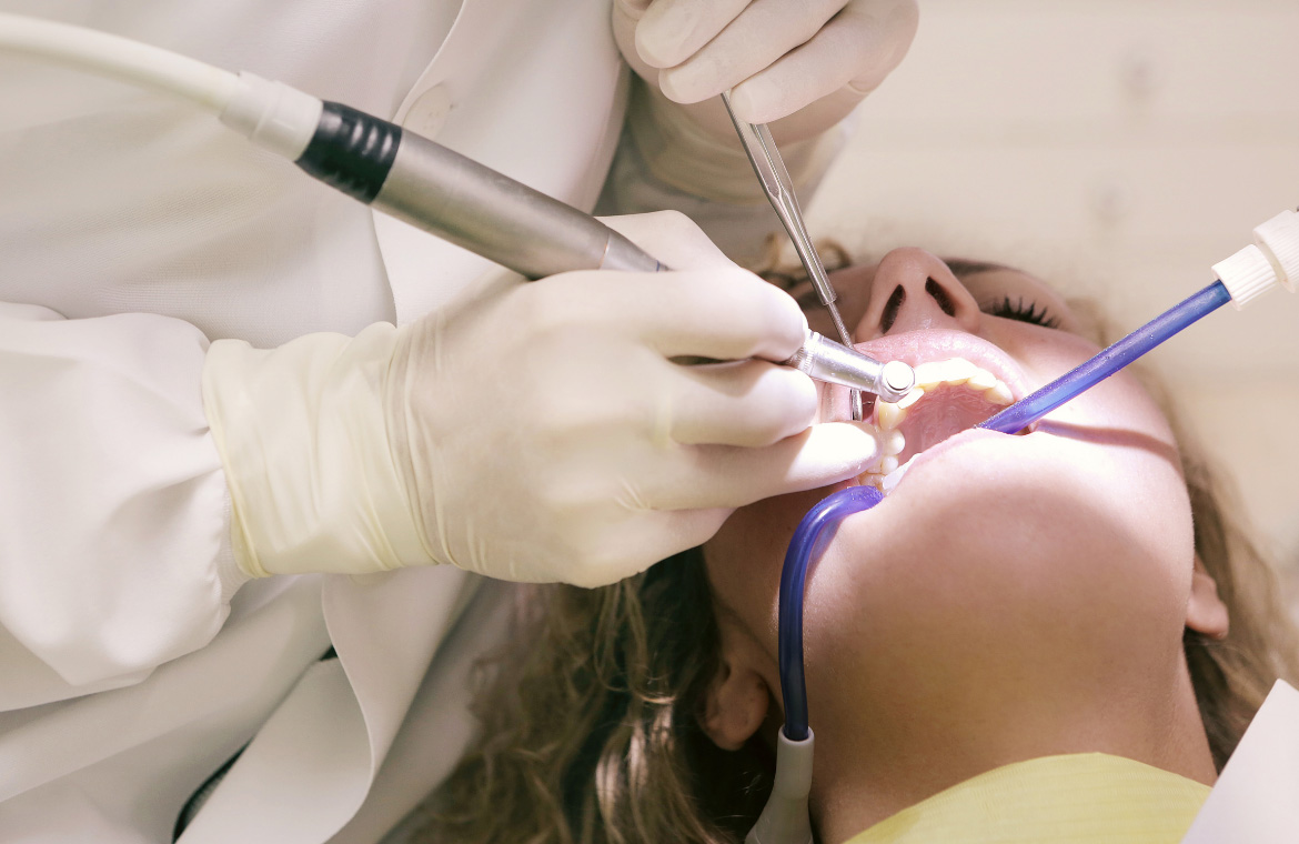 Protege tu salud bucodental con las limpiezas profesionales de Clínica Dental Simón
