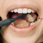 Revisa tu salud bucodental después del verano en Clínica Dental Simón