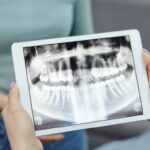 Todas las ventajas de iniciar tu tratamiento de ortodoncia invisible en Clínica Dental Simón
