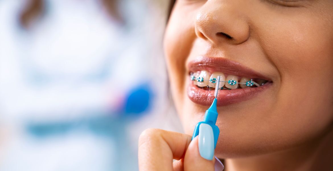 La importancia de la higiene interdental para una sonrisa radiante y un corazón sano