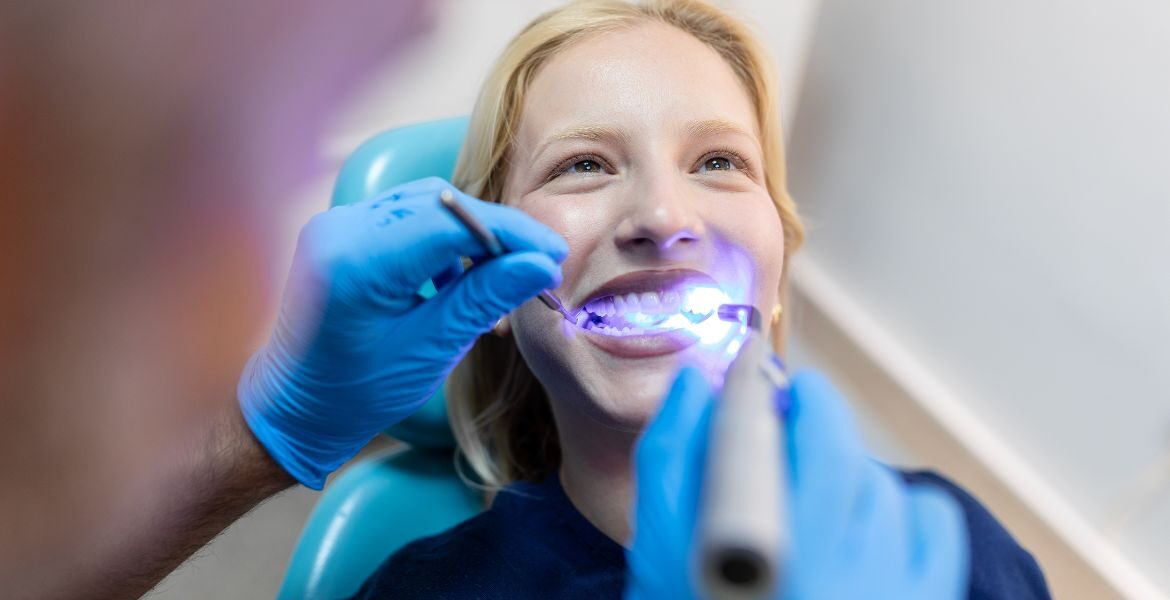 Estos son los pasos cruciales para asegurar resultados óptimos en un blanqueamiento dental