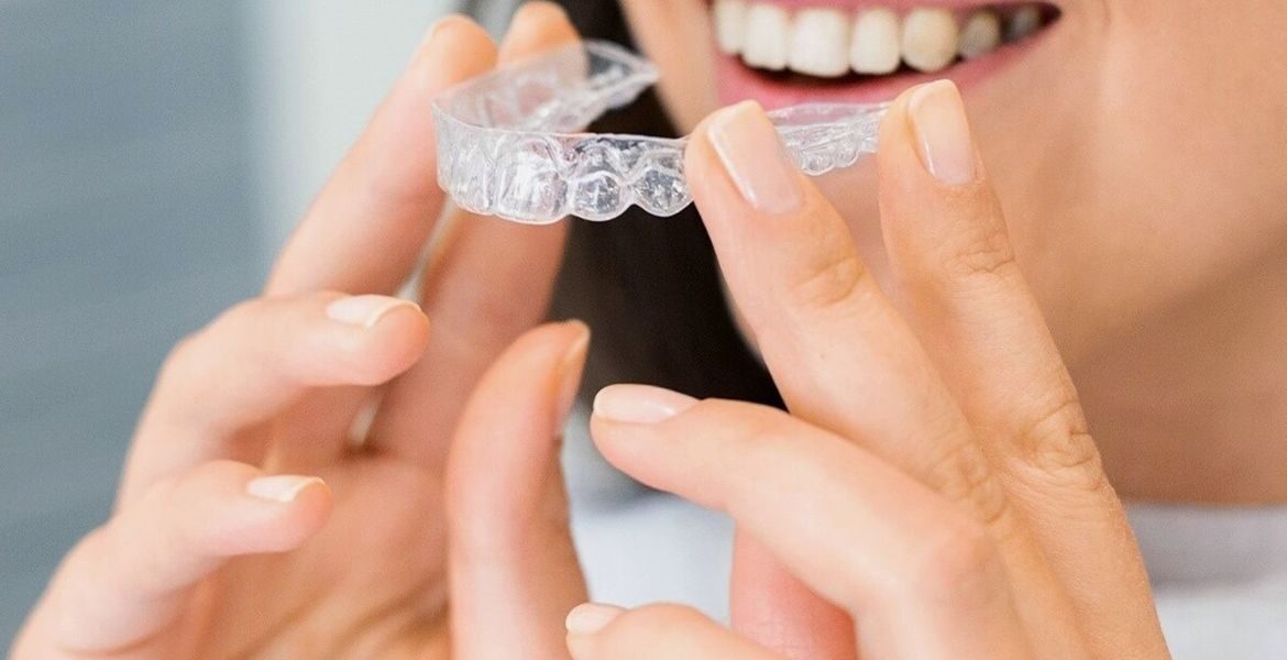 ¿Cuándo es apropiado comenzar el tratamiento de ortodoncia invisible?
