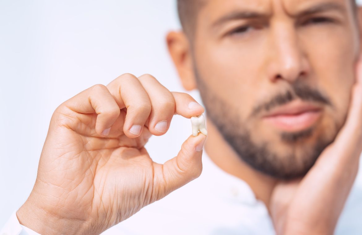 ¿Cómo debo actuar si pierdo un diente durante las vacaciones?