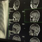 El secreto para mantener tu memoria en forma empieza en tus encías